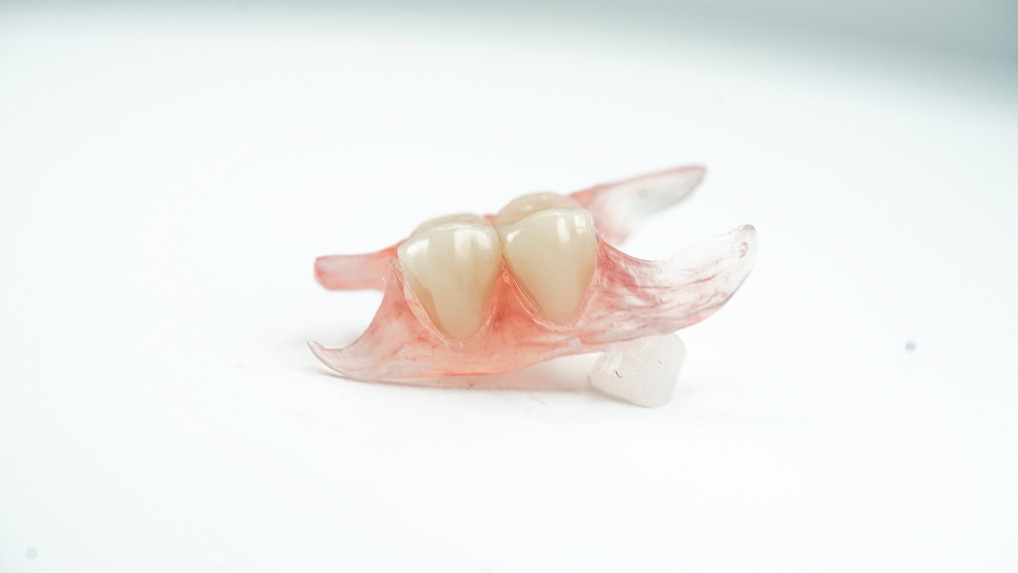 Sunflex Thermoplastic Partial Denture
